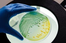 Warning over ‘fast-moving’ E coli outbreak spreading in US
