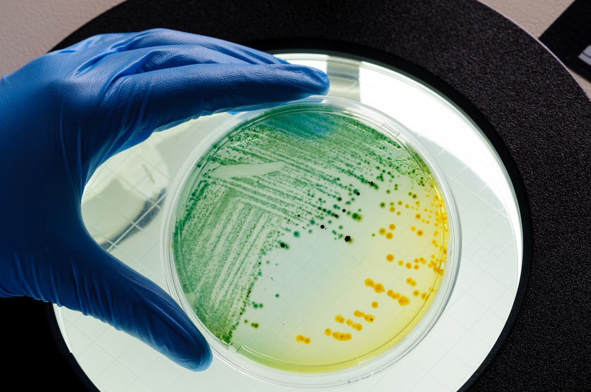 Сирене, което може да е отговорно за 30 случая на E.coli, изтеглени от магазините