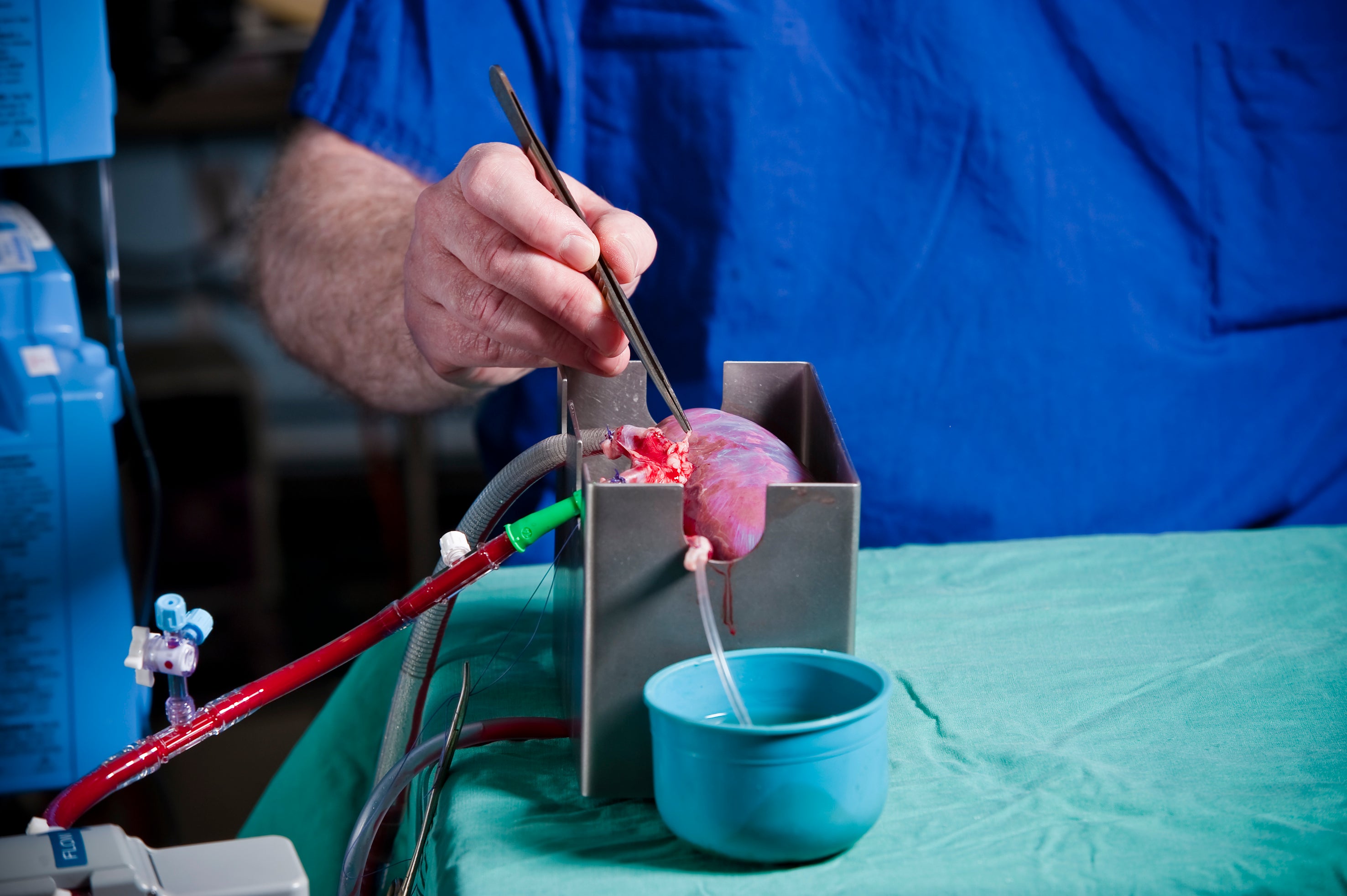 Transplant hope for minorities as researchers alter donor kidney blood type (Kidney Research UK/PA)