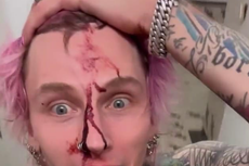 Machine Gun Kelly shares image of his bloody face after he smashes another glass on himself