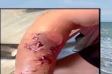 Two shark bites reported in the past week at popular South Carolina beach