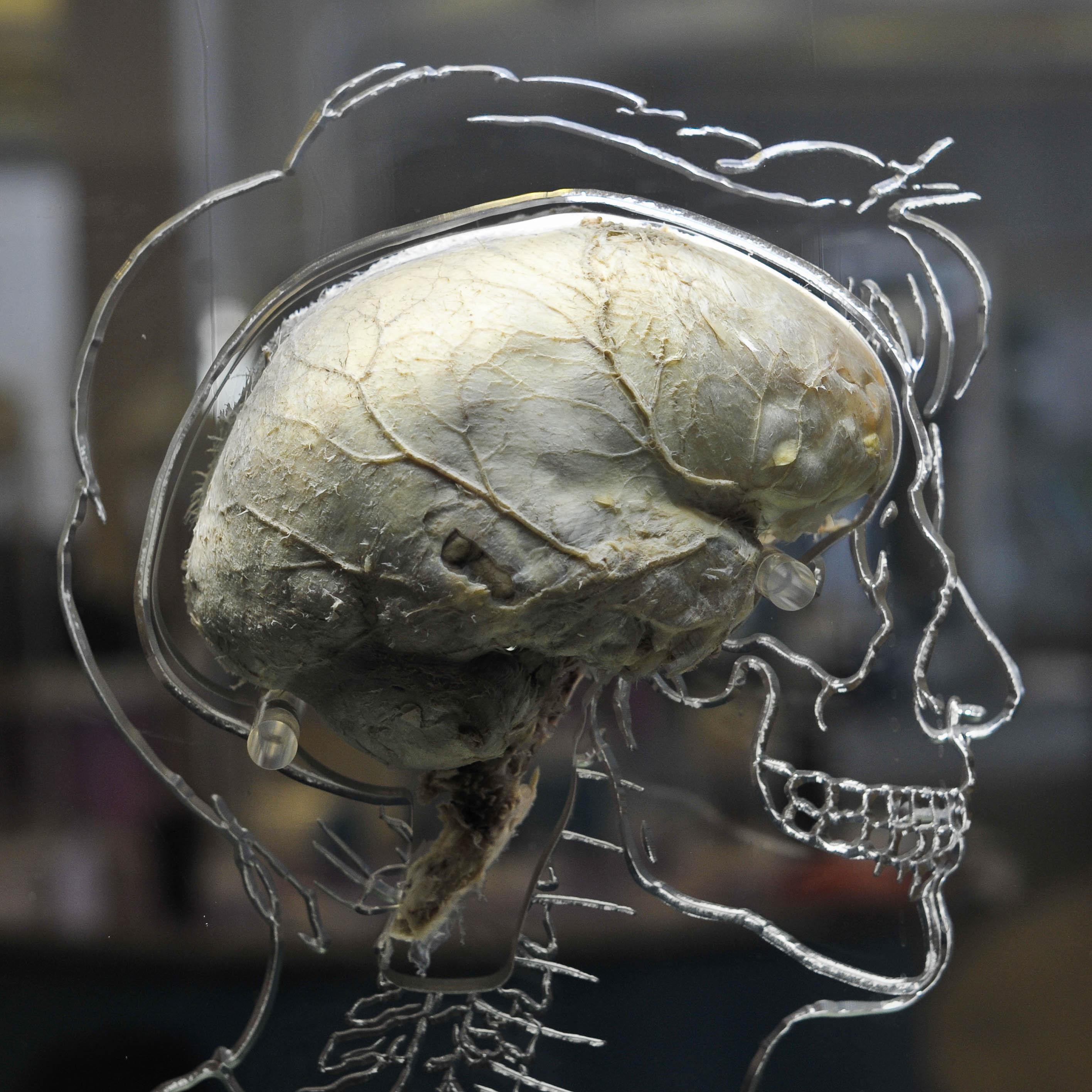 Brain stimulation improves memory for at least one month, study suggests (Ben Birchall/PA)