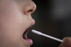 Researchers find majority of long Covid patients are women