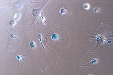 Zombie cells central to the quest for active, vital old age