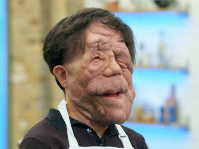 <p>Adam Pearson on ‘Celebrity Masterchef’</p>