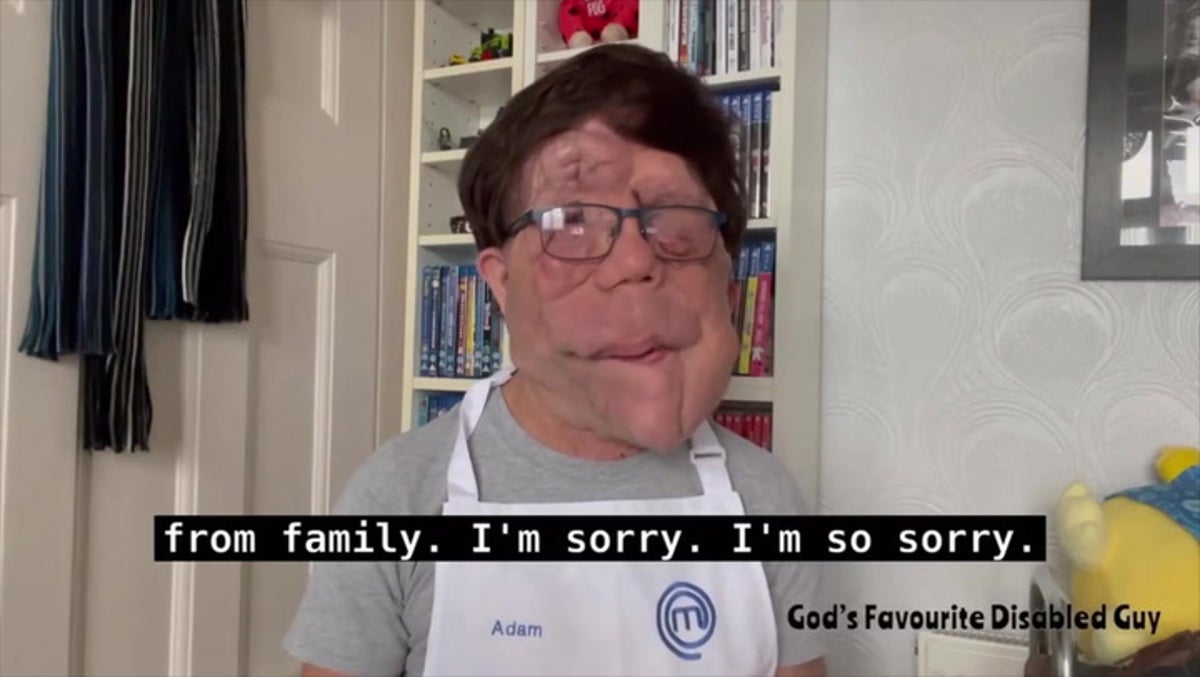 Adam Pearson gives ‘sarcastic’ apology to Celebrity MasterChef viewers