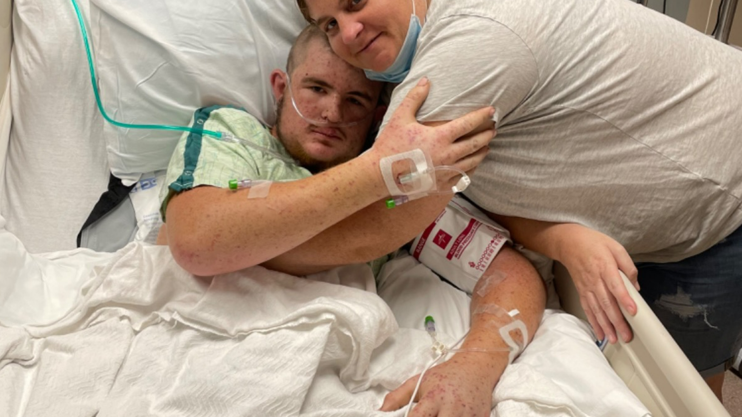 Ohio man wakes up from coma after he was stung by bees over 20,000 times