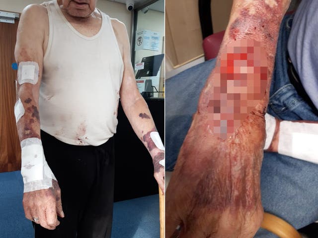 <p>Pictures shared on Twitter show grim injuries on elderly man </p>
