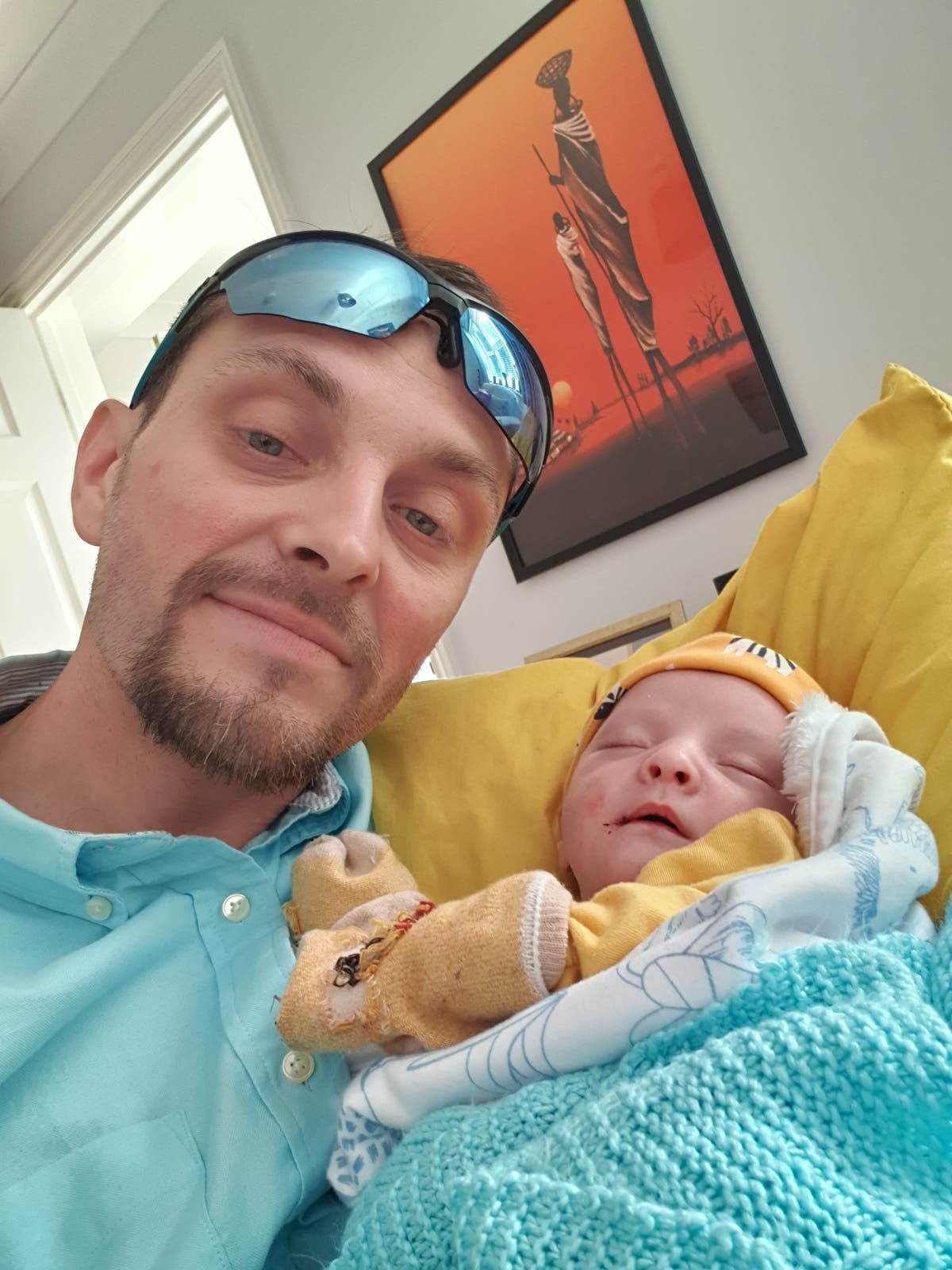 Baby&rsquo;s &lsquo;butterfly skin&rsquo; leaves parents terrified to cuddle him