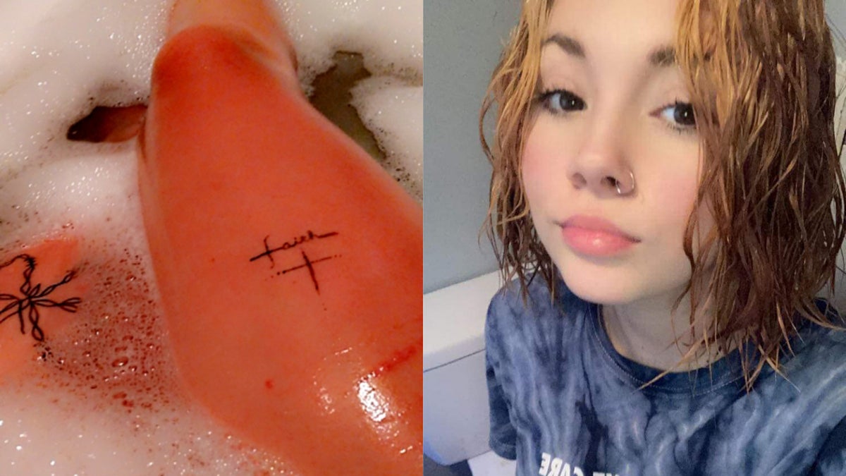 Aquagenic urticaria: Teen suddenly develops allergy to water | The  Independent