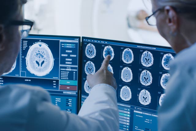 <p>Medical professionals study brain scans from patient’s MRI procedure</p>