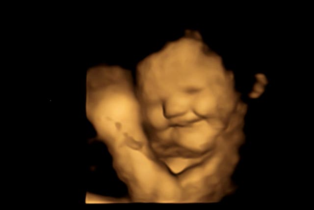 <p>A 4D ultrasound image of a baby reacting to the flavour of carrots</p>