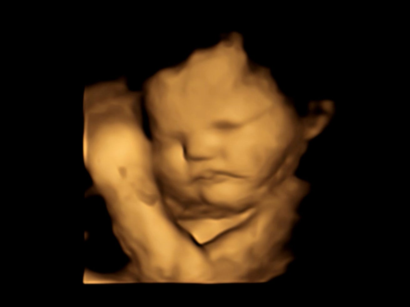 A 4D ultrasound image of a baby taken before flavours were introduced