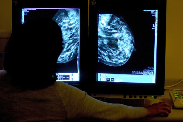 Researchers have called for breast cancer surgery guidelines to be revised (PA)