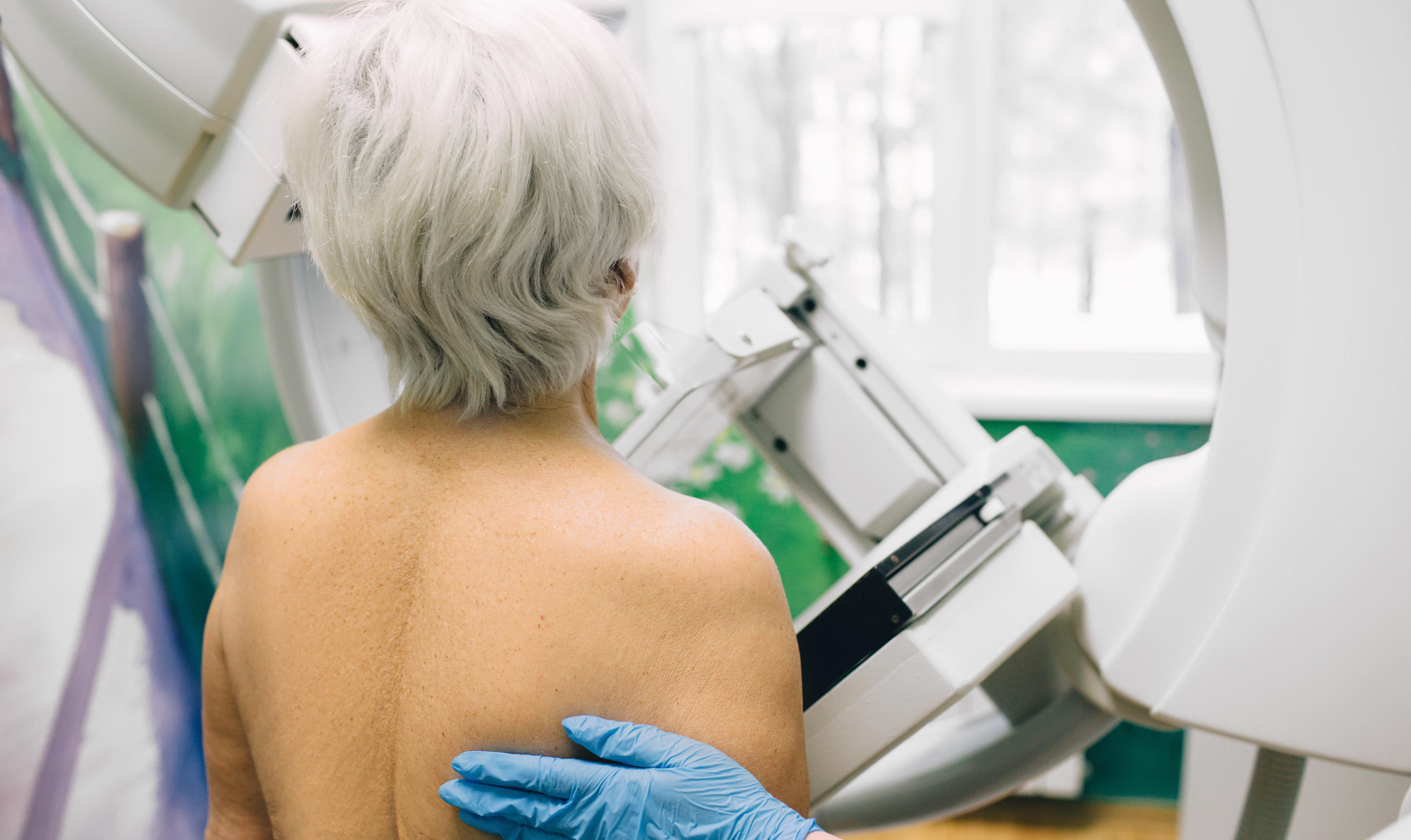 A woman having a mammogram. New research says delays to getting results is affecting cancer screening (Alamy/PA)