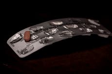 Cholesterol drug could be used in treatment of prostate cancer, study finds