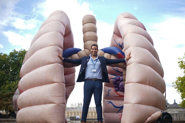 Dr Chris George beside a large inflatable lung at St Thomas’ Hospital during the launch of the Let’s Talk Lung Cancer Roadshow (Yui Mok/PA)