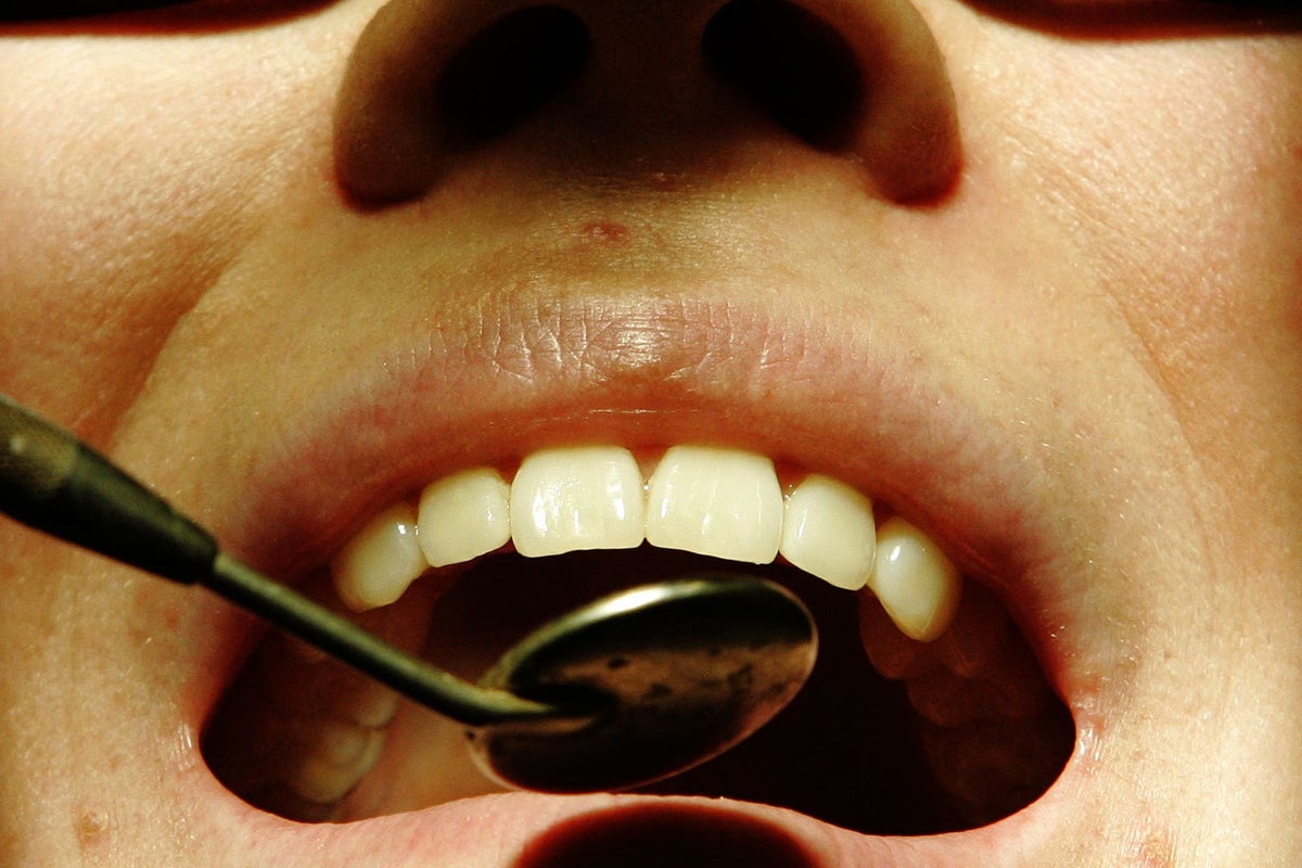 Number of ‘dental deserts’ across England growing, figures show