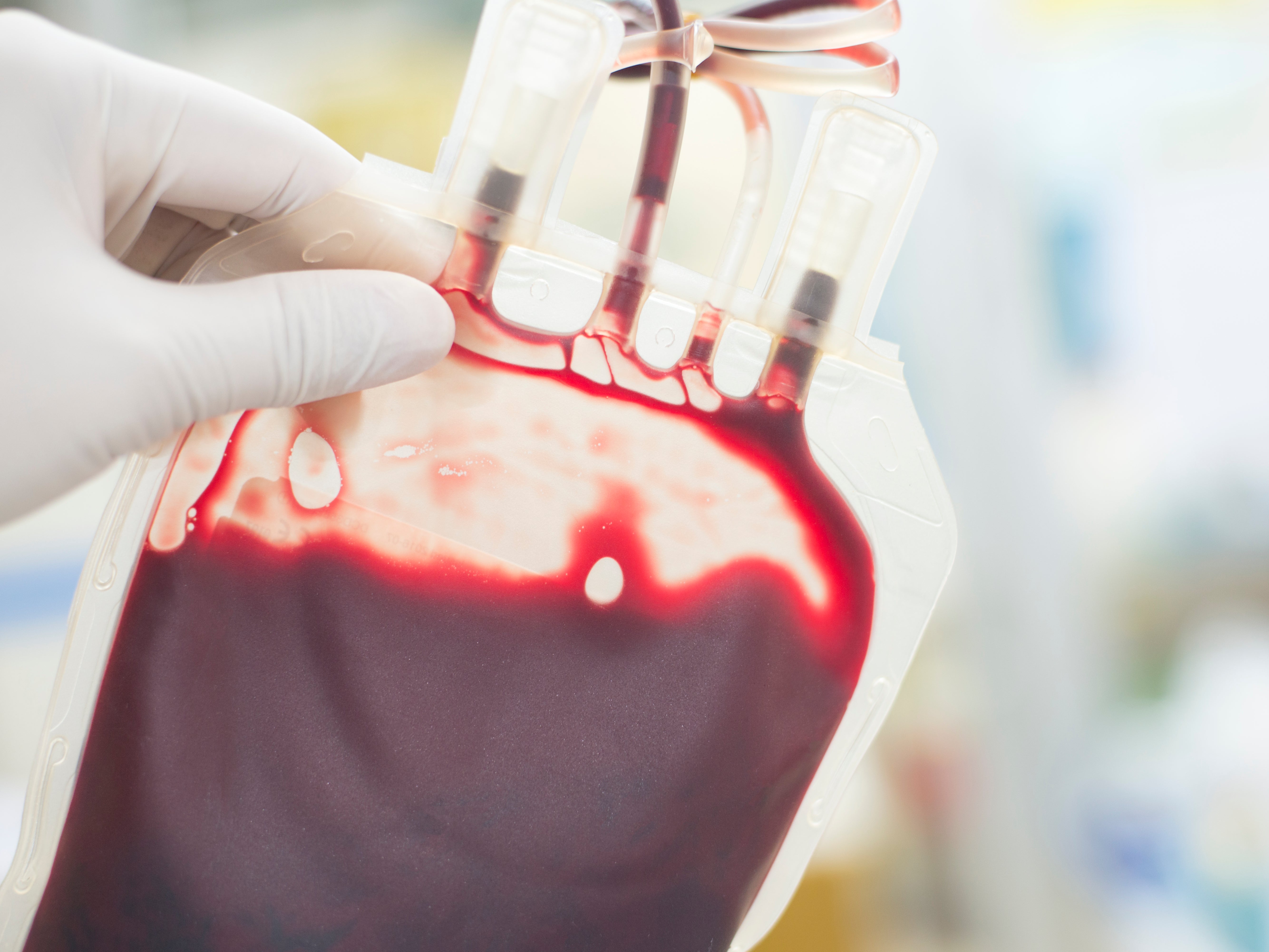 Thousands were infected with contaminated blood in the NHS treatment scandal