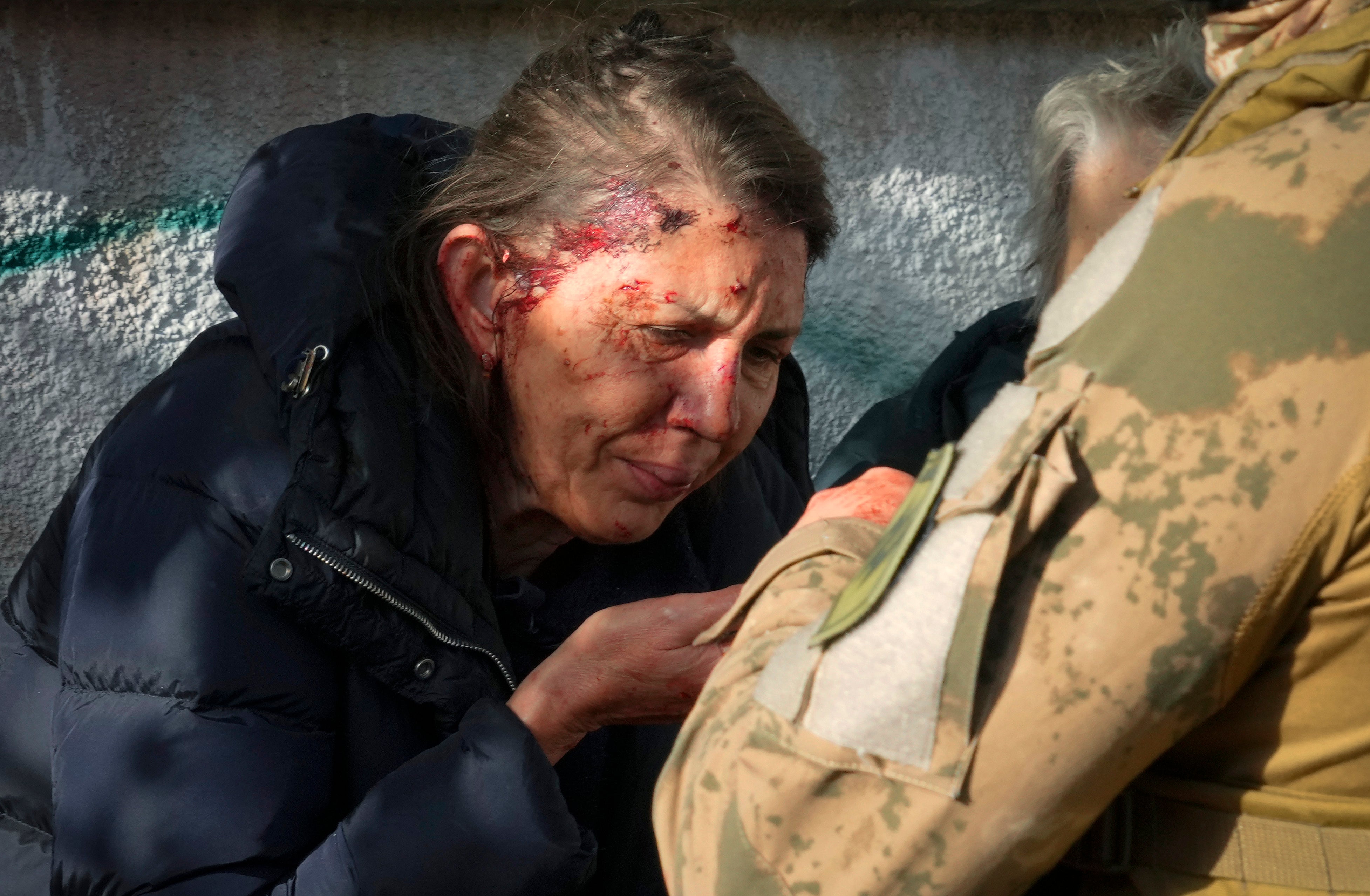 An injured woman reacts after Russian shelling in Kyiv