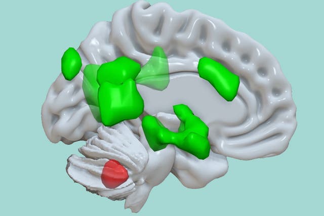 <p>Brain’s cerebellum (activation in red) connects with different areas of the cerebrum (activations in green) to enhance the storage of emotional information</p>