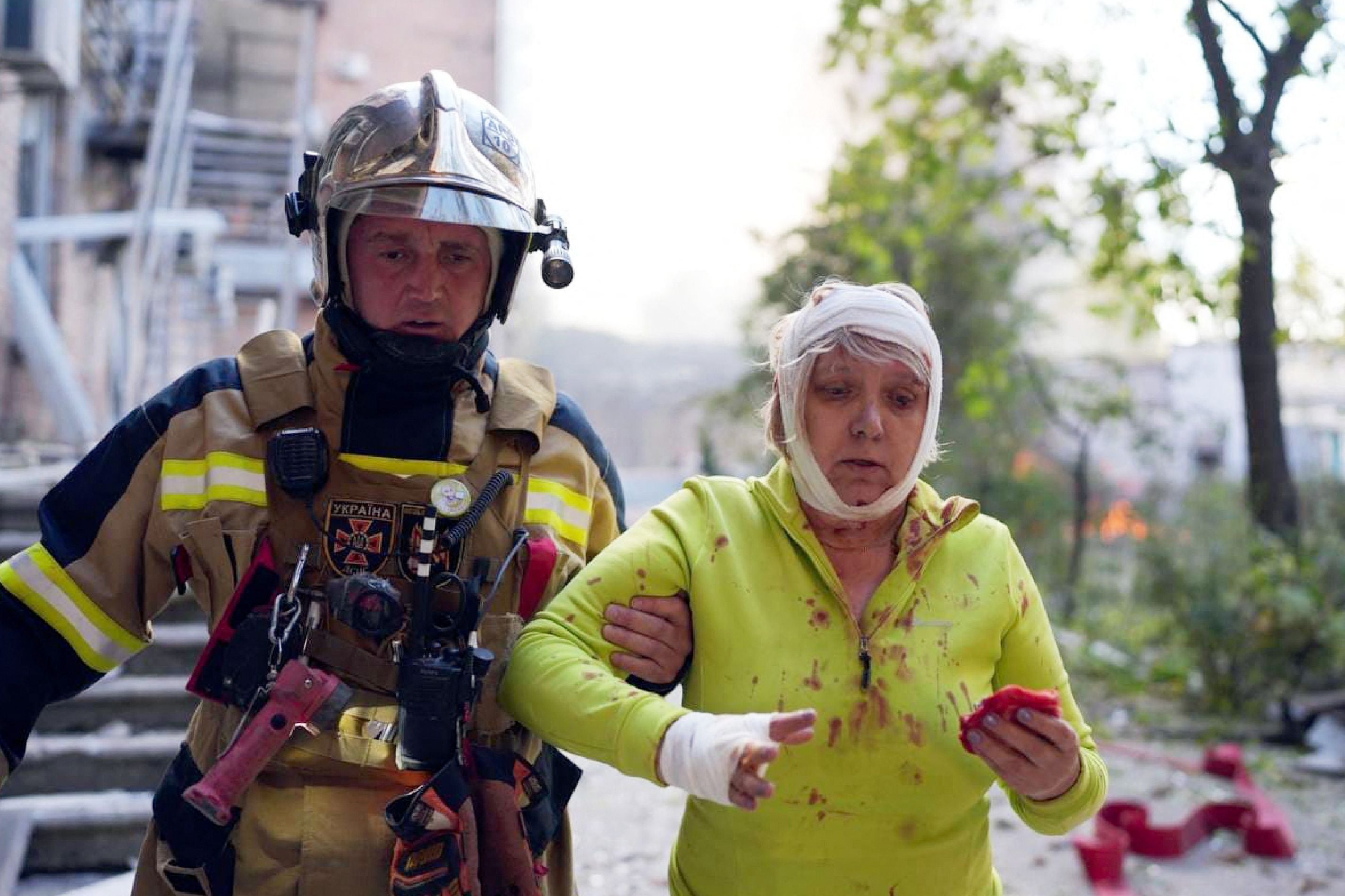 A rescuer helping an injured woman at the site of shelling in Kyiv