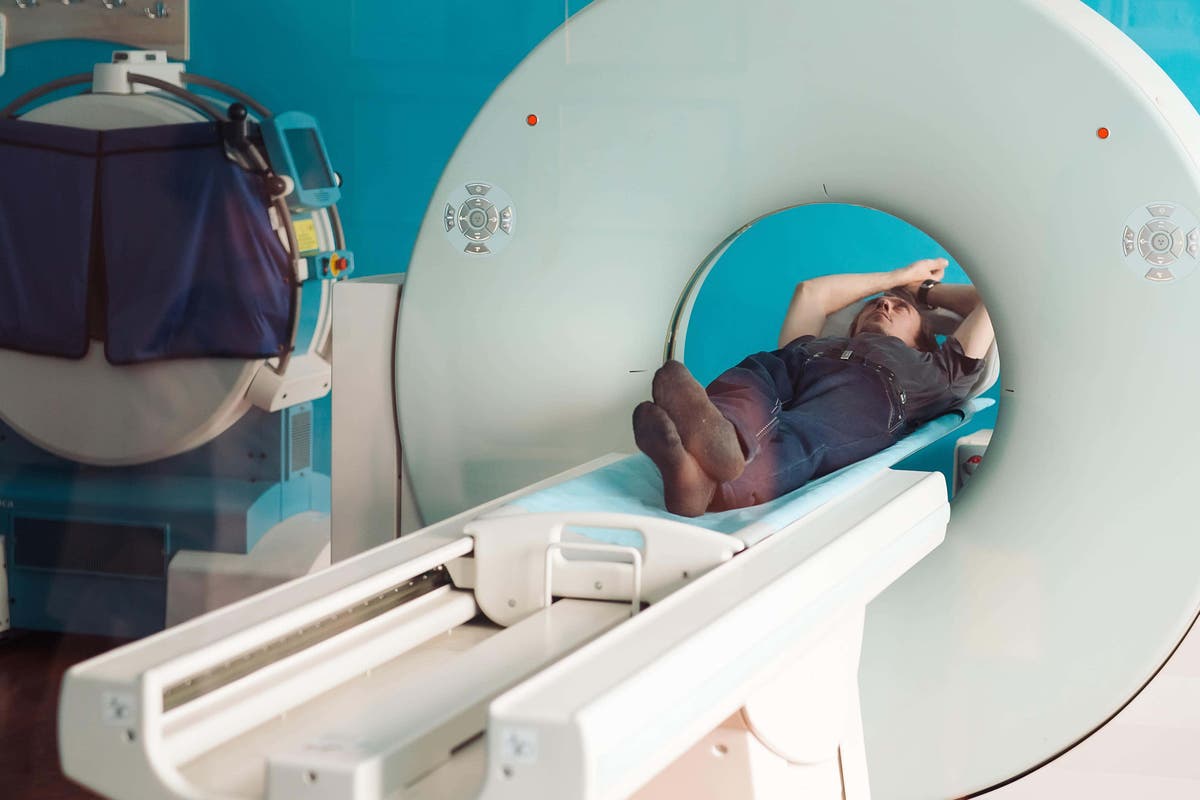 Study highlights concern over &lsquo;missed&rsquo; pancreatic cancer in scans