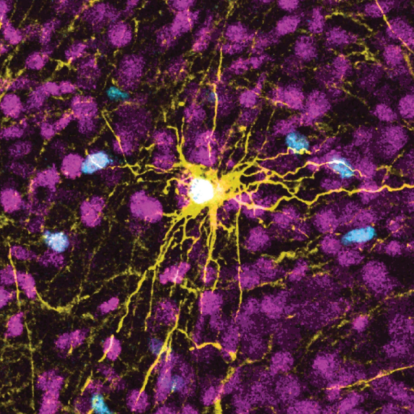 CÉLULAS CEREBRALES EN RATAS