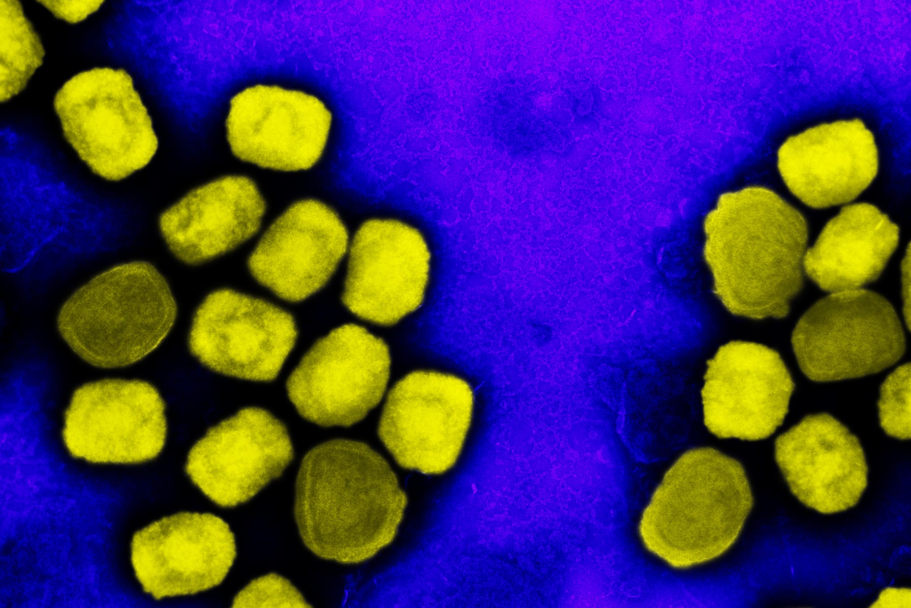 A colorized transmission electron micrograph of monkeypox virus particles (yellow)