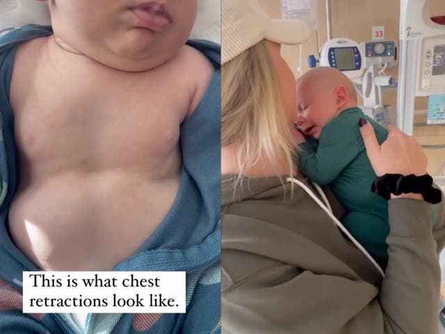 <p>Parenting influencer shares video of her infant experiencing chest retractions as a reminder to parents to trust their instincts </p>