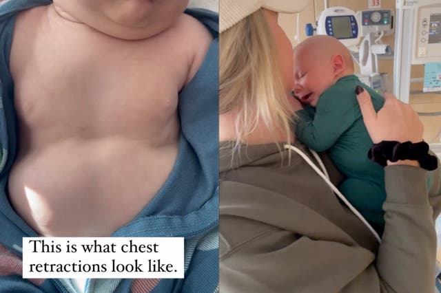 <p>Parenting influencer shares video of her infant experiencing chest retractions as a reminder to parents to trust their instincts </p>