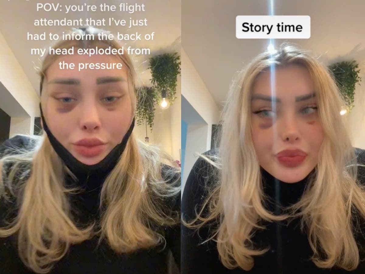 People are horrified after woman explains how her head &lsquo;exploded&rsquo; mid-flight