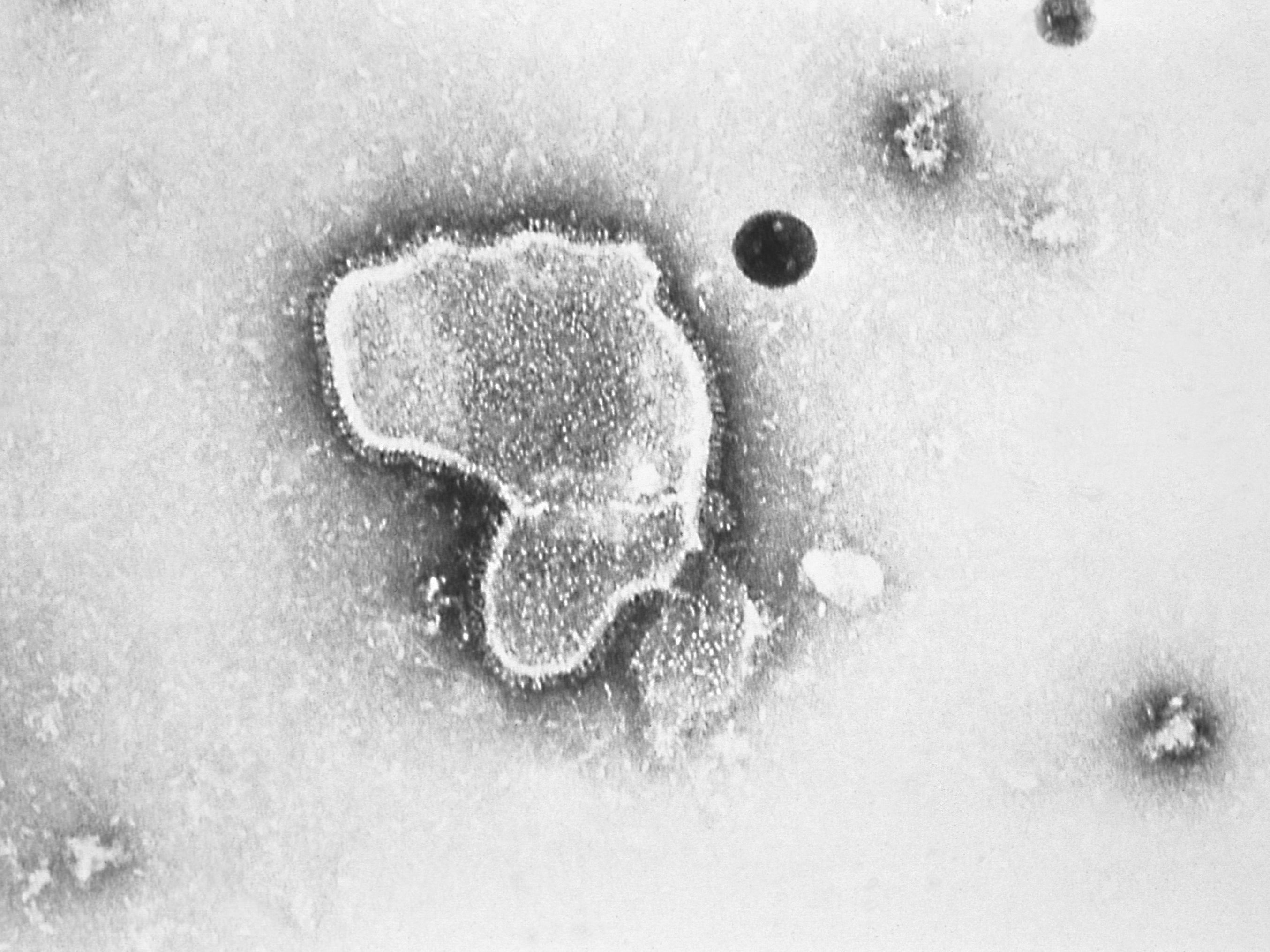 An electron micrograph of respiratory syncytial virus, or RSV