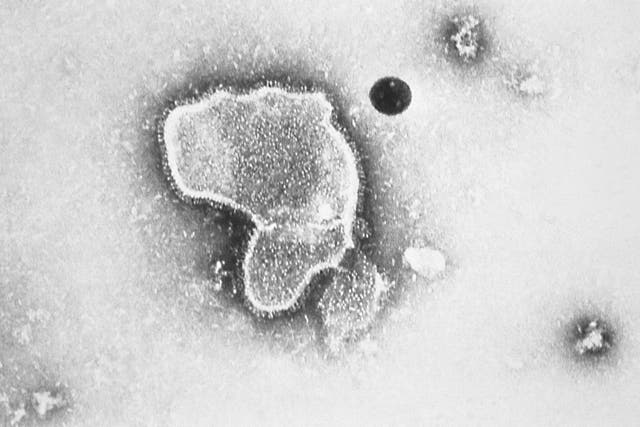 <p>An electron micrograph of respiratory syncytial virus, or RSV</p>