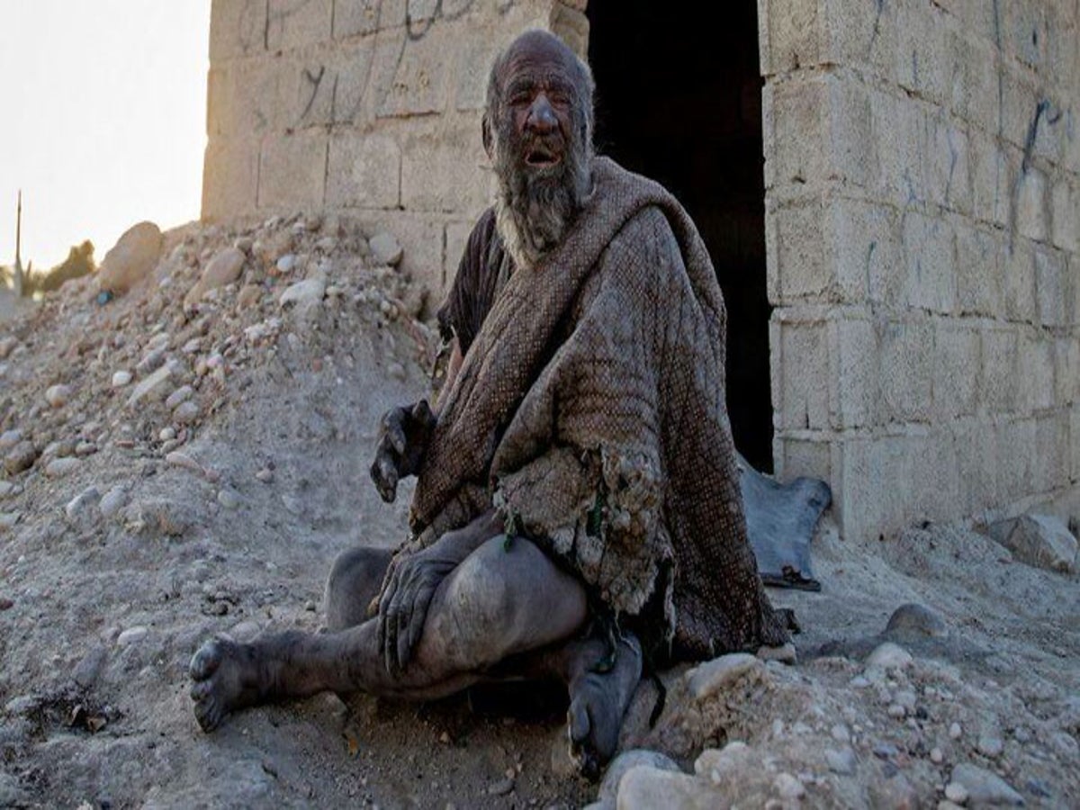 World's dirtiest man' dies after bathing once in 60 years: Here's