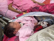 Woman in seven-month coma gives birth to baby girl
