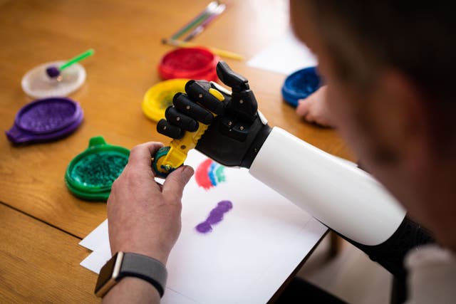 Darren Fuller is the first person to receive a 3D-printed bionic arm on the NHS (Open Bionics/PA)