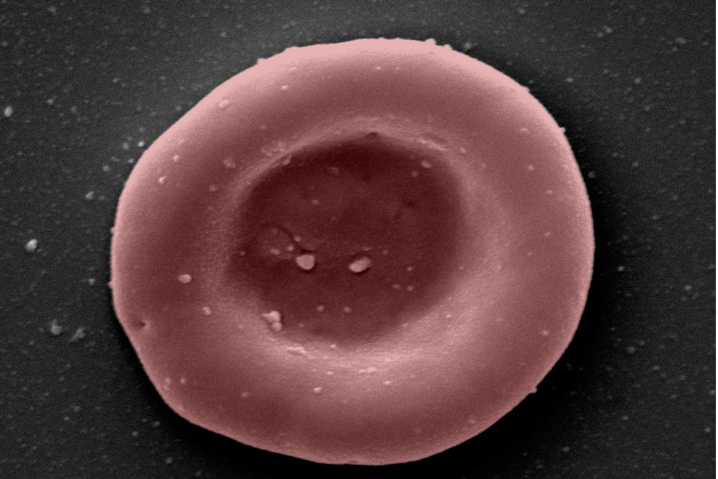 ‘Lab-grown red blood cells transfused in to person in a world first’ (NHSBT/PA)