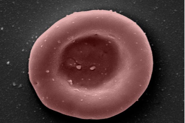 ‘Lab-grown red blood cells transfused in to person in a world first’ (NHSBT/PA)