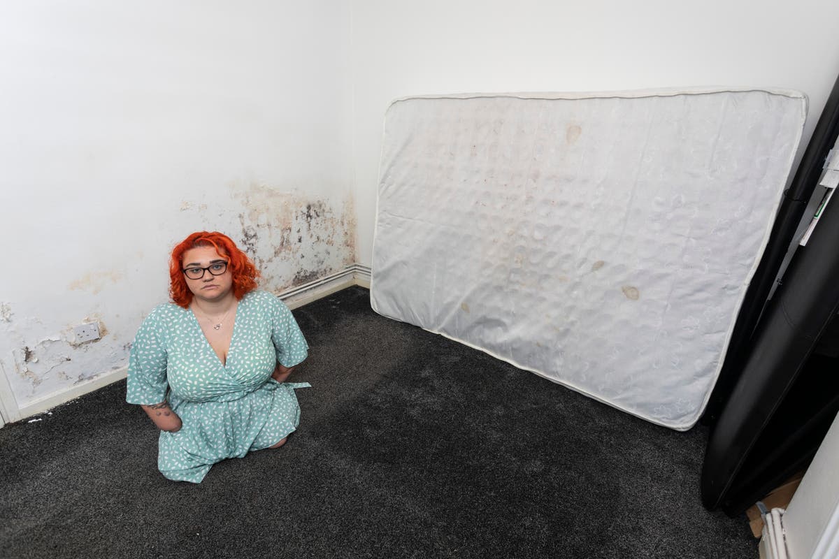 Quadruple amputee begs Leeds City Council to act as black mould-ridden flat leaves her without a toilet