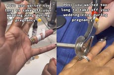 Pregnant woman forced to cut off wedding ring after eight years due to swelling