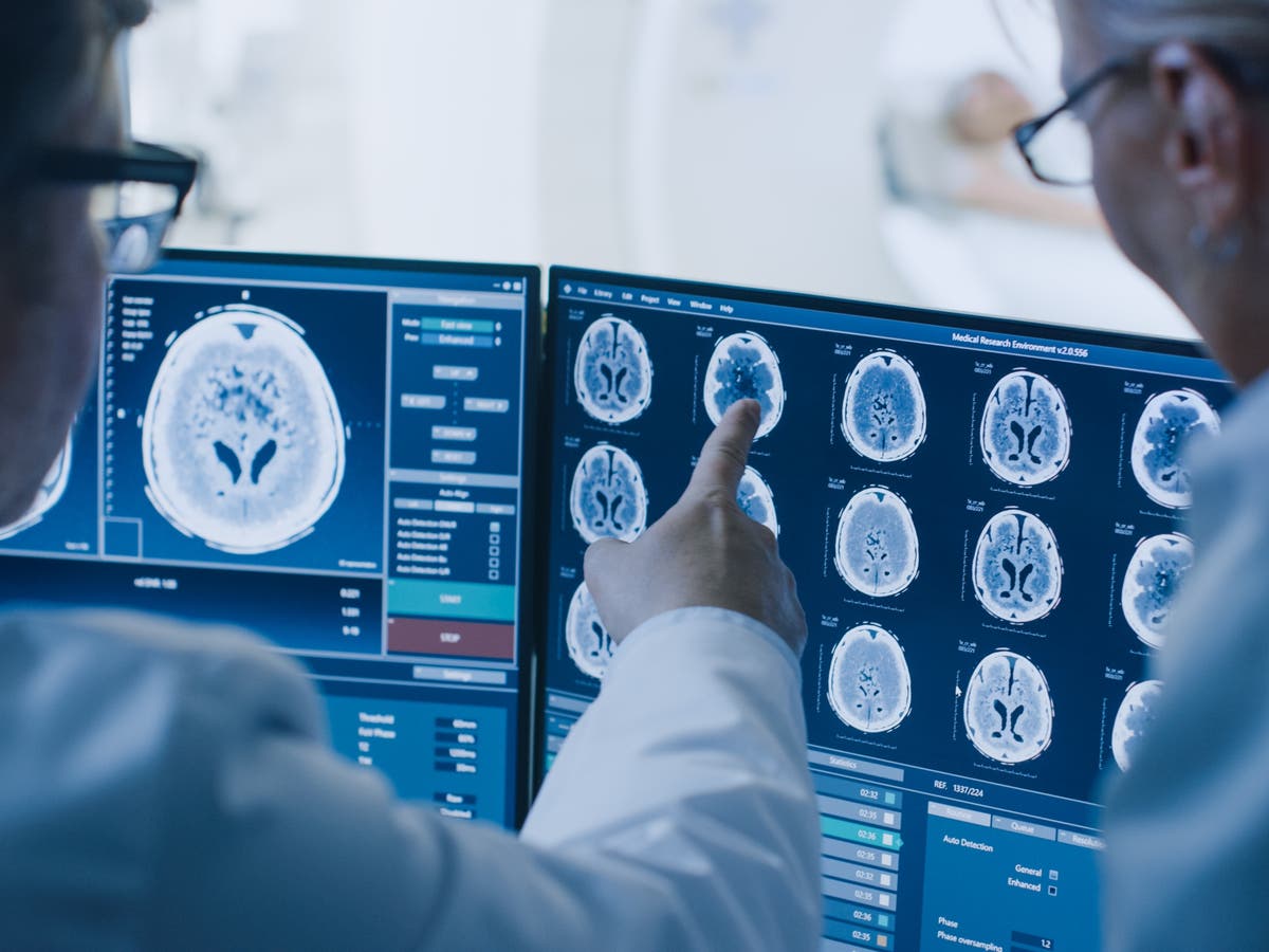 GPs urged to order scans for &lsquo;vague&rsquo; cancer symptoms like fatigue and dizziness