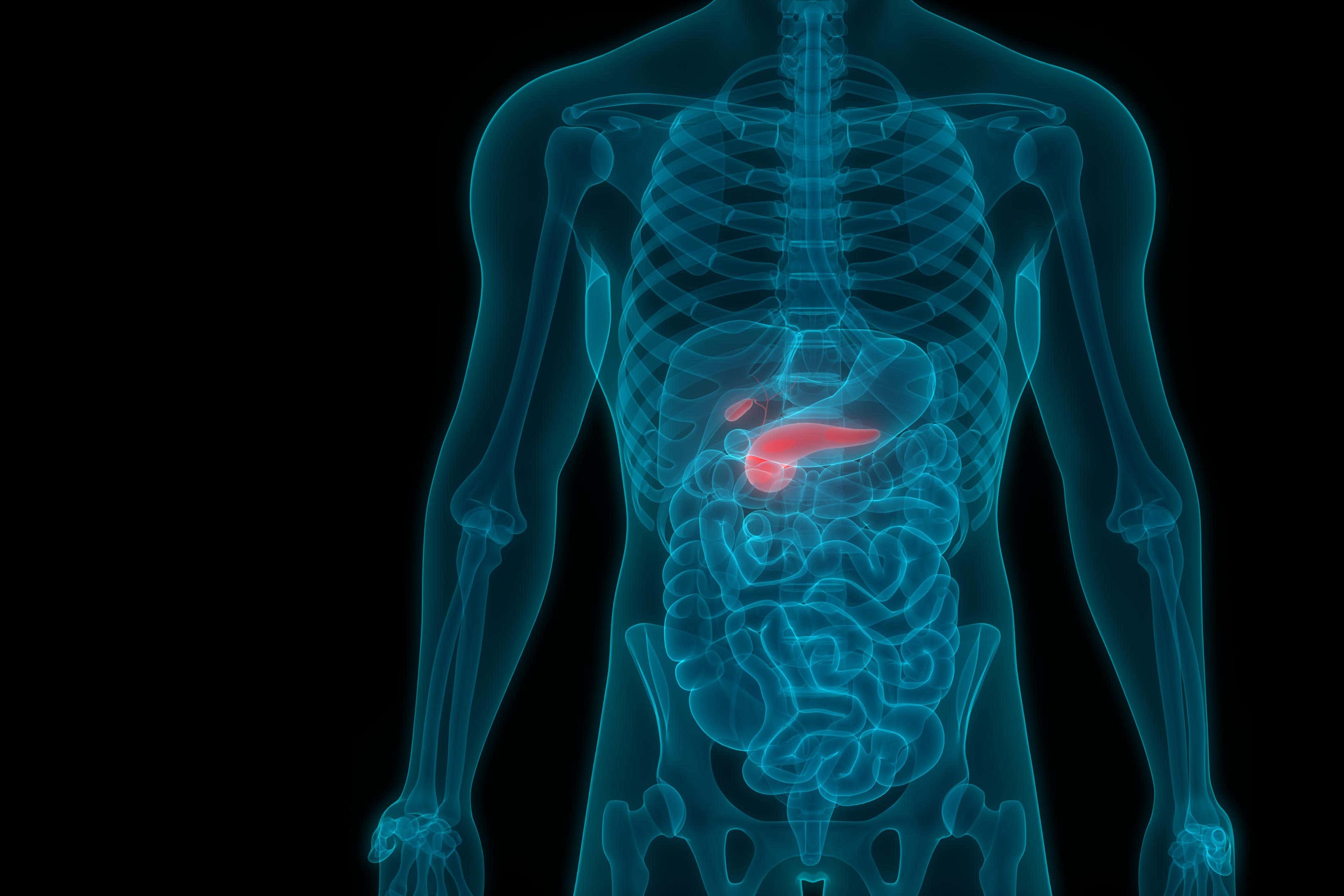 Pancreatic Cancer Spread To Blood