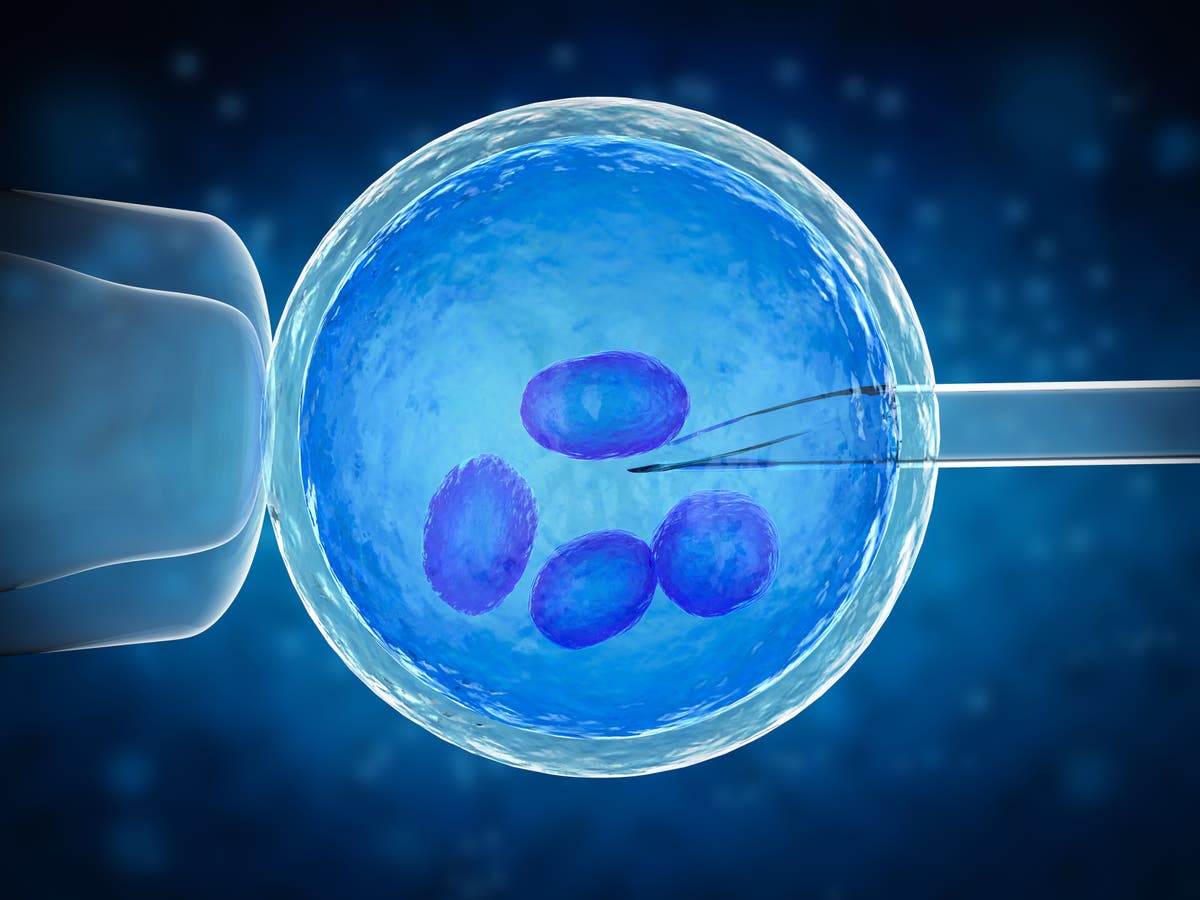 In vitro fertilization это