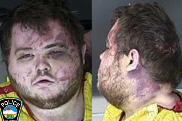 <p>Booking photo of Anderson Lee Aldrich, suspect in the Colorado Springs nightclub mass shooting</p>
