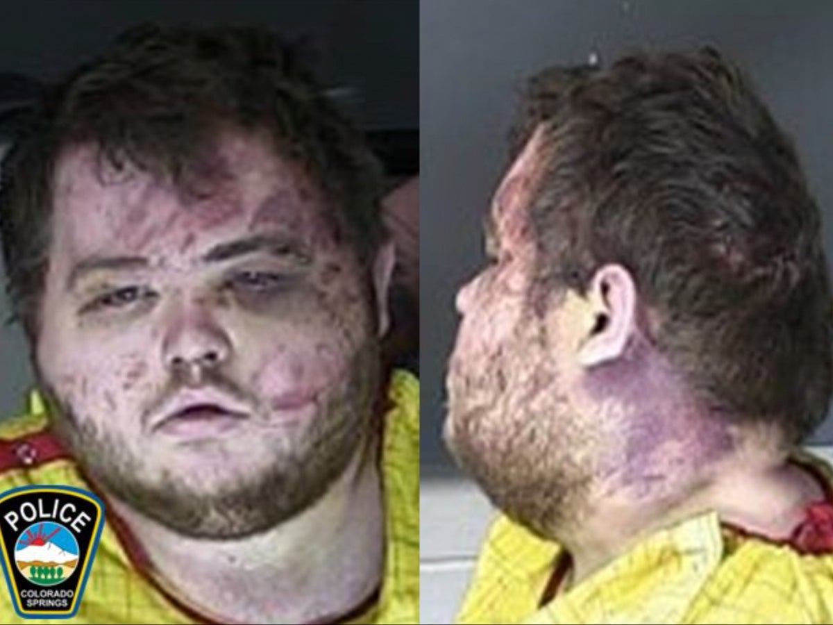 Mugshot, Colorado Springs şüphelisini yüz ve boyun yaralarıyla gösteriyor