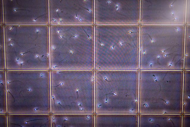 <p>This picture taken on 28 September 2022 shows a computer monitor displaying magnified donor sperm at Keio University Hospital in Tokyo</p>