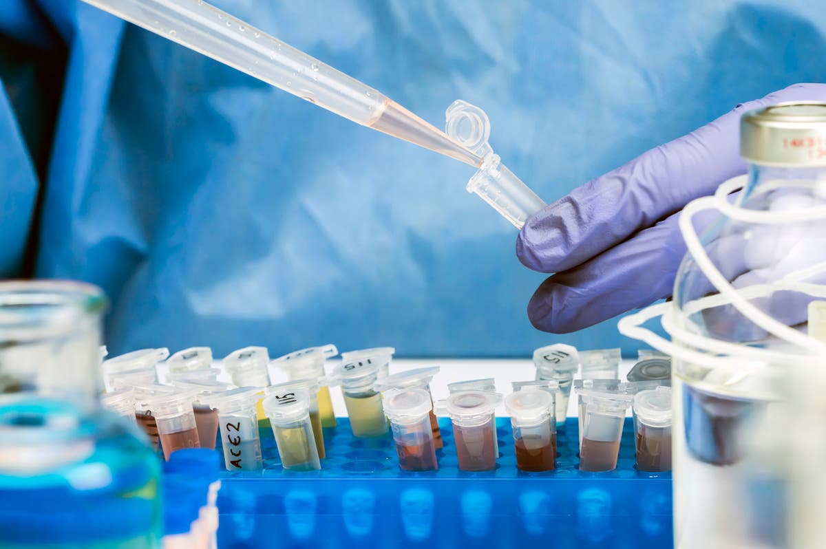 Covid lab mistakes could have led to deaths of 20 people