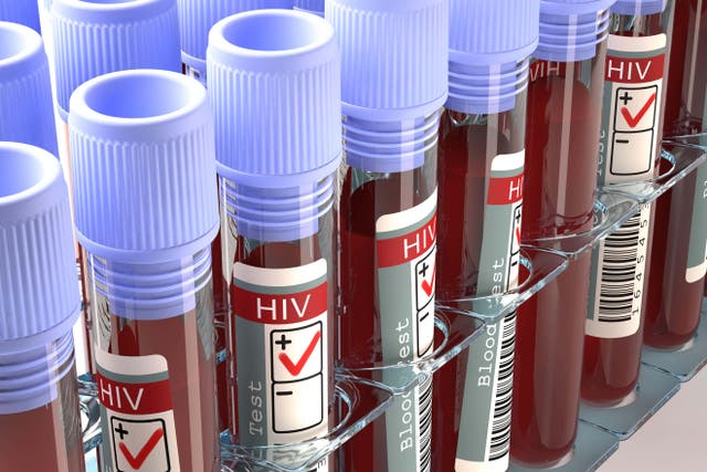 Fewer HIV checks were conducted during the coronavirus crisis (Alamy/PA)