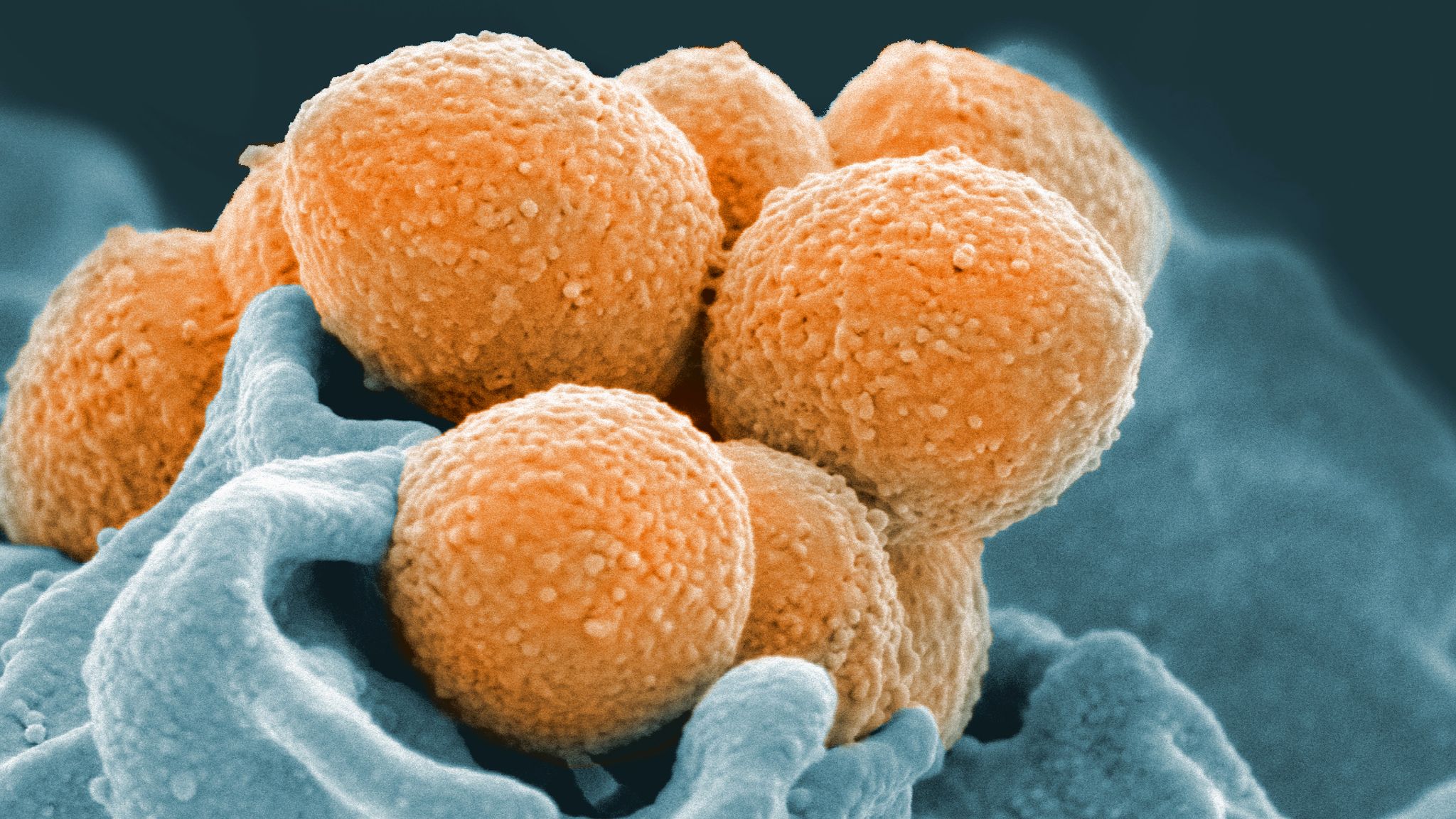 Strep A bacteria can cause the life-threatening Group A Streptococcal disease